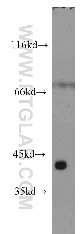 Western Blot (WB) analysis of mouse heart tissue using ST8SIA2-Specific Polyclonal antibody (19736-1-AP)