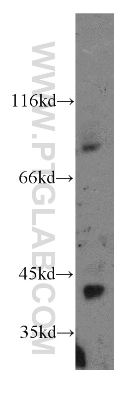 Western Blot (WB) analysis of mouse heart tissue using ST8SIA2-Specific Polyclonal antibody (19736-1-AP)