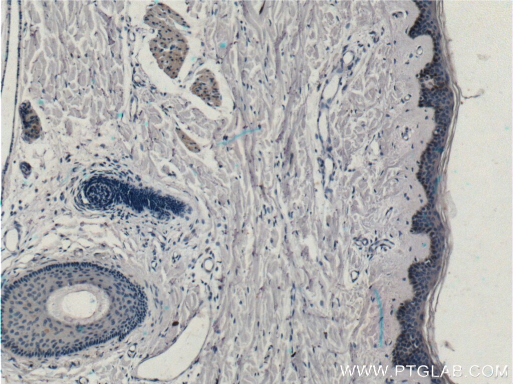 Immunohistochemistry (IHC) staining of human skin tissue using ST8SIA3 Polyclonal antibody (18004-1-AP)