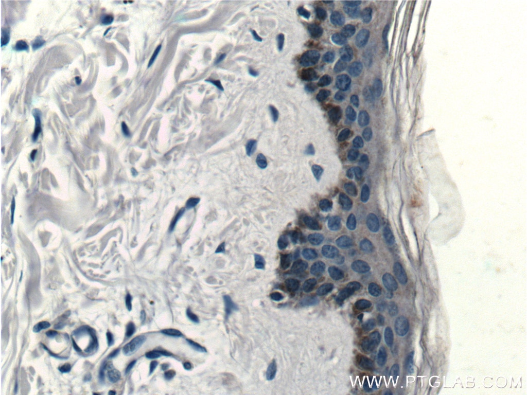 Immunohistochemistry (IHC) staining of human skin tissue using ST8SIA3 Polyclonal antibody (18004-1-AP)