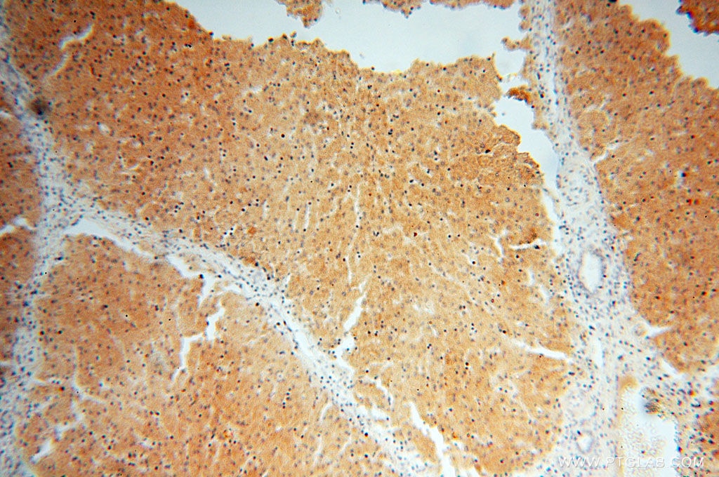 Immunohistochemistry (IHC) staining of human liver tissue using ST8SIA3 Polyclonal antibody (18004-1-AP)