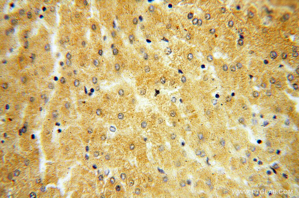 Immunohistochemistry (IHC) staining of human liver tissue using ST8SIA3 Polyclonal antibody (18004-1-AP)