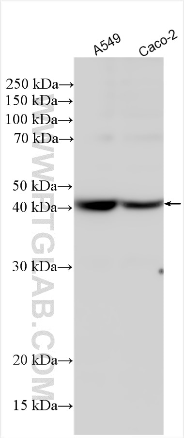 Western Blot (WB) analysis of various lysates using ST8SIA3 Polyclonal antibody (18004-1-AP)
