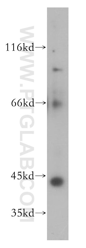 Western Blot (WB) analysis of mouse liver tissue using ST8SIA3 Polyclonal antibody (18004-1-AP)