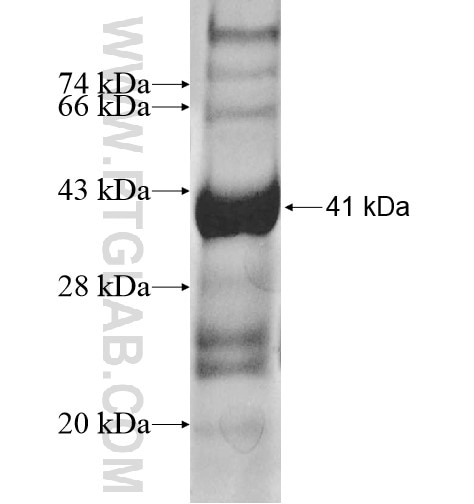 ST8SIA3 fusion protein Ag12497 SDS-PAGE