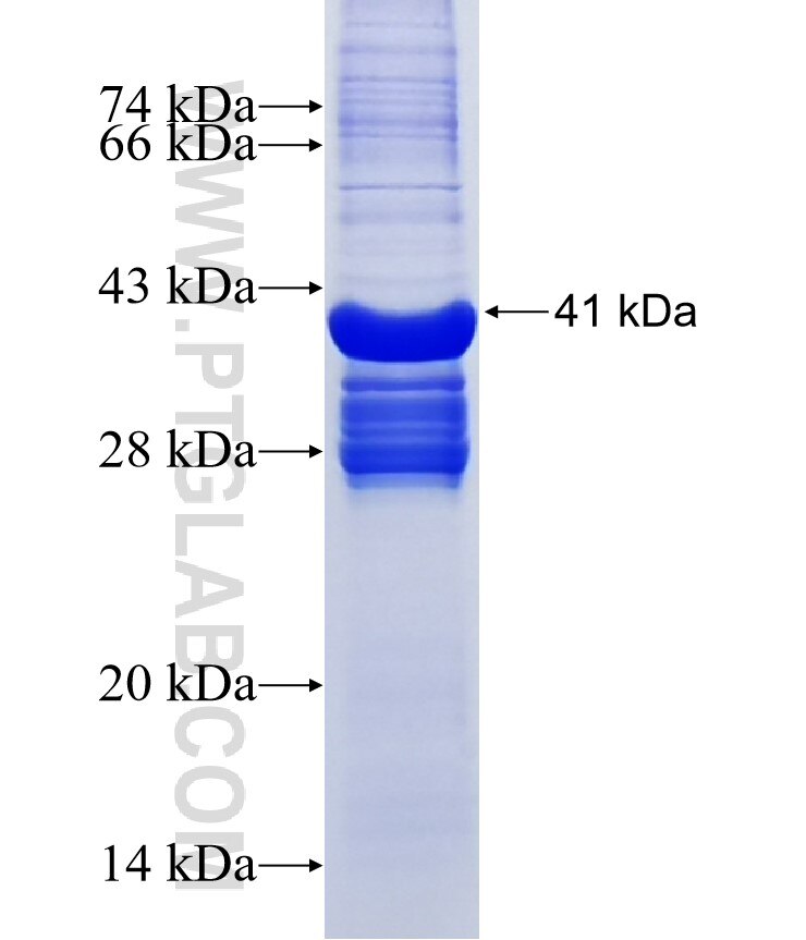 ST8SIA5 fusion protein Ag15708 SDS-PAGE