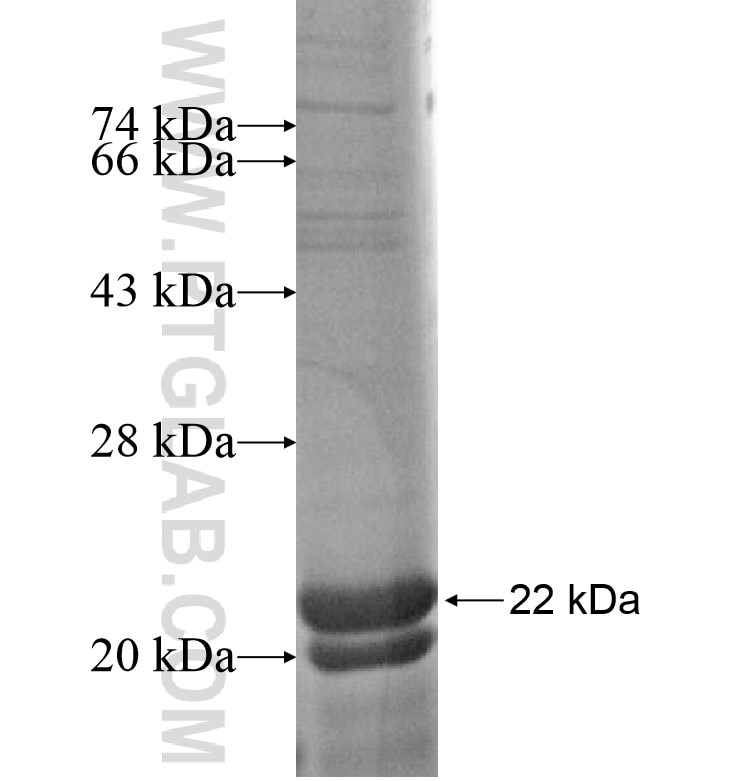 ST8SIA5 fusion protein Ag16557 SDS-PAGE