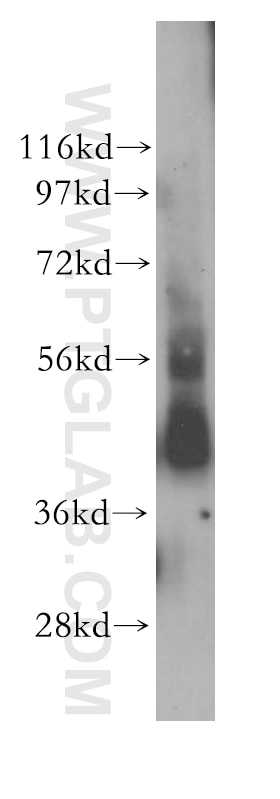 Western Blot (WB) analysis of human liver tissue using STAC Polyclonal antibody (11480-1-AP)