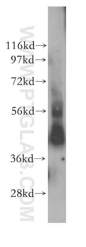 WB analysis of human liver using 11480-1-AP