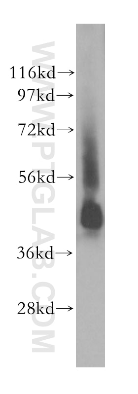 Western Blot (WB) analysis of PC-3 cells using STAC Polyclonal antibody (11480-1-AP)