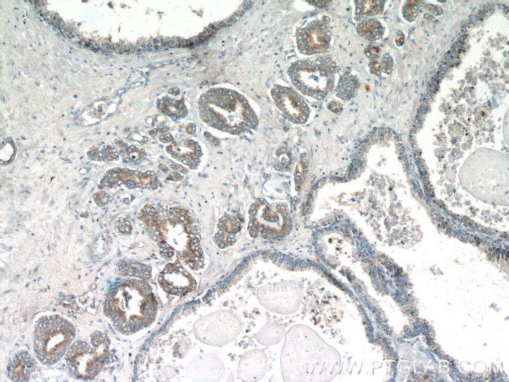 Immunohistochemistry (IHC) staining of human prostate hyperplasia tissue using STAC2 Polyclonal antibody (24274-1-AP)