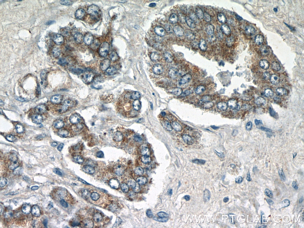 Immunohistochemistry (IHC) staining of human prostate hyperplasia tissue using STAC2 Polyclonal antibody (24274-1-AP)