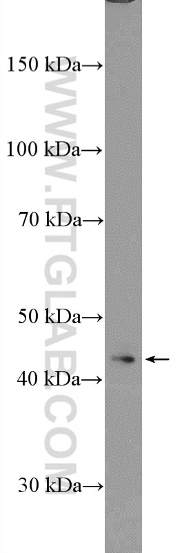 WB analysis of SH-SY5Y using 24274-1-AP