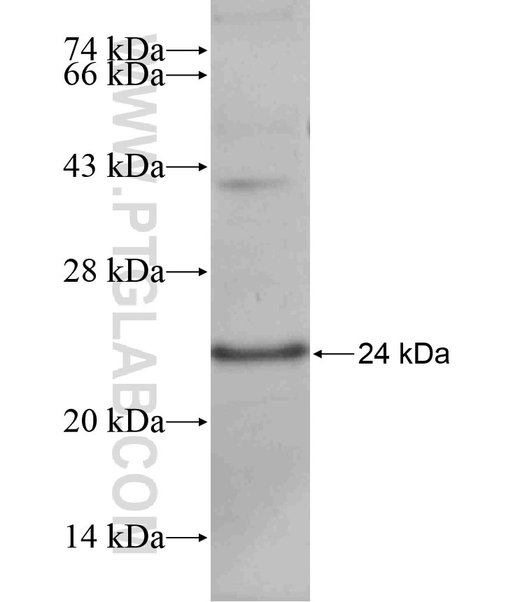 STAC2 fusion protein Ag17976 SDS-PAGE