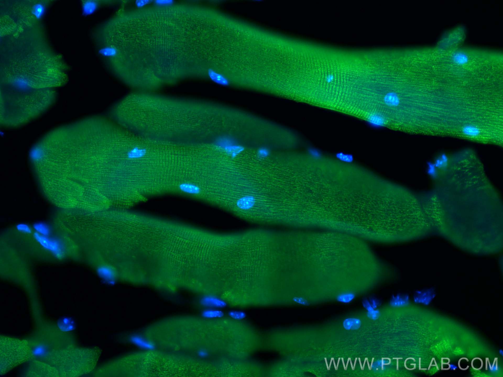 IF Staining of mouse skeletal muscle using 20392-1-AP