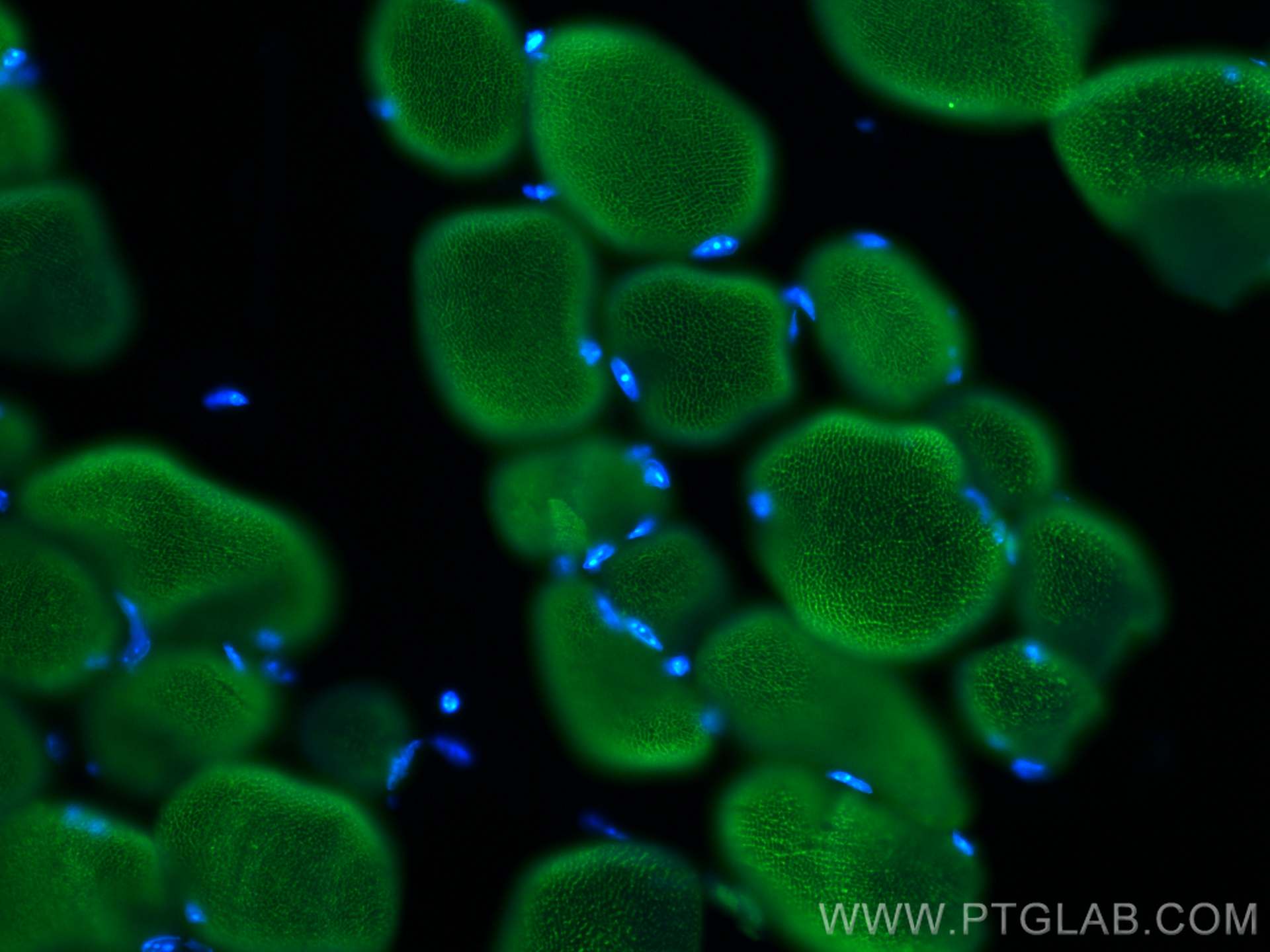 IF Staining of mouse skeletal muscle using 20392-1-AP