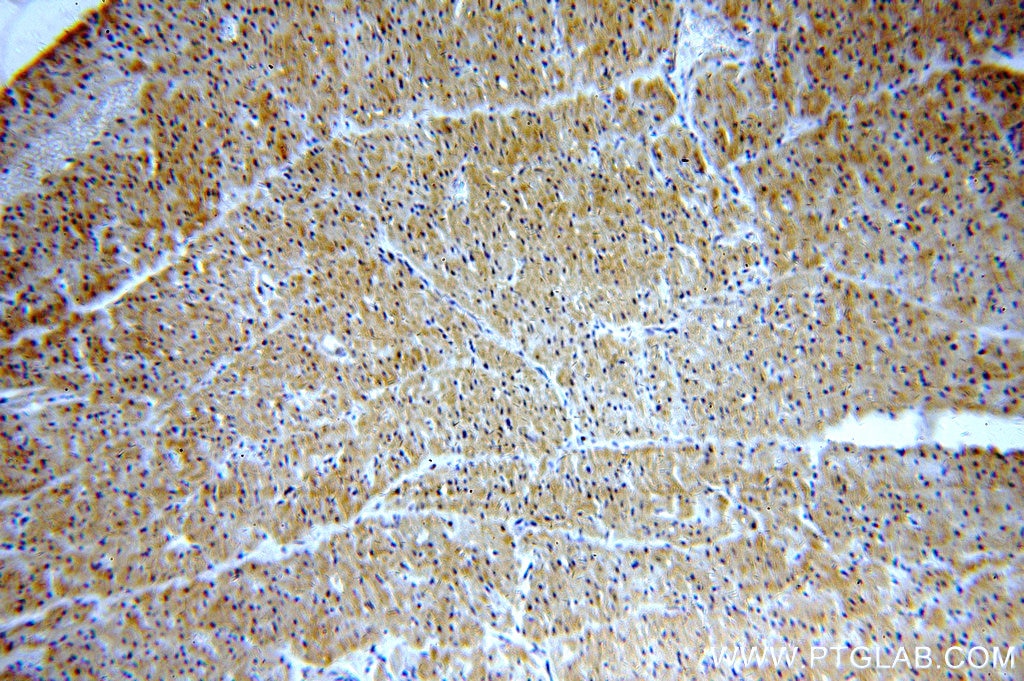 Immunohistochemistry (IHC) staining of human heart tissue using STAC3 Polyclonal antibody (20392-1-AP)