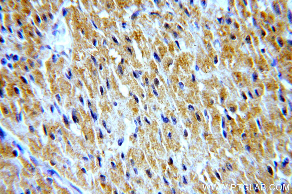 Immunohistochemistry (IHC) staining of human heart tissue using STAC3 Polyclonal antibody (20392-1-AP)