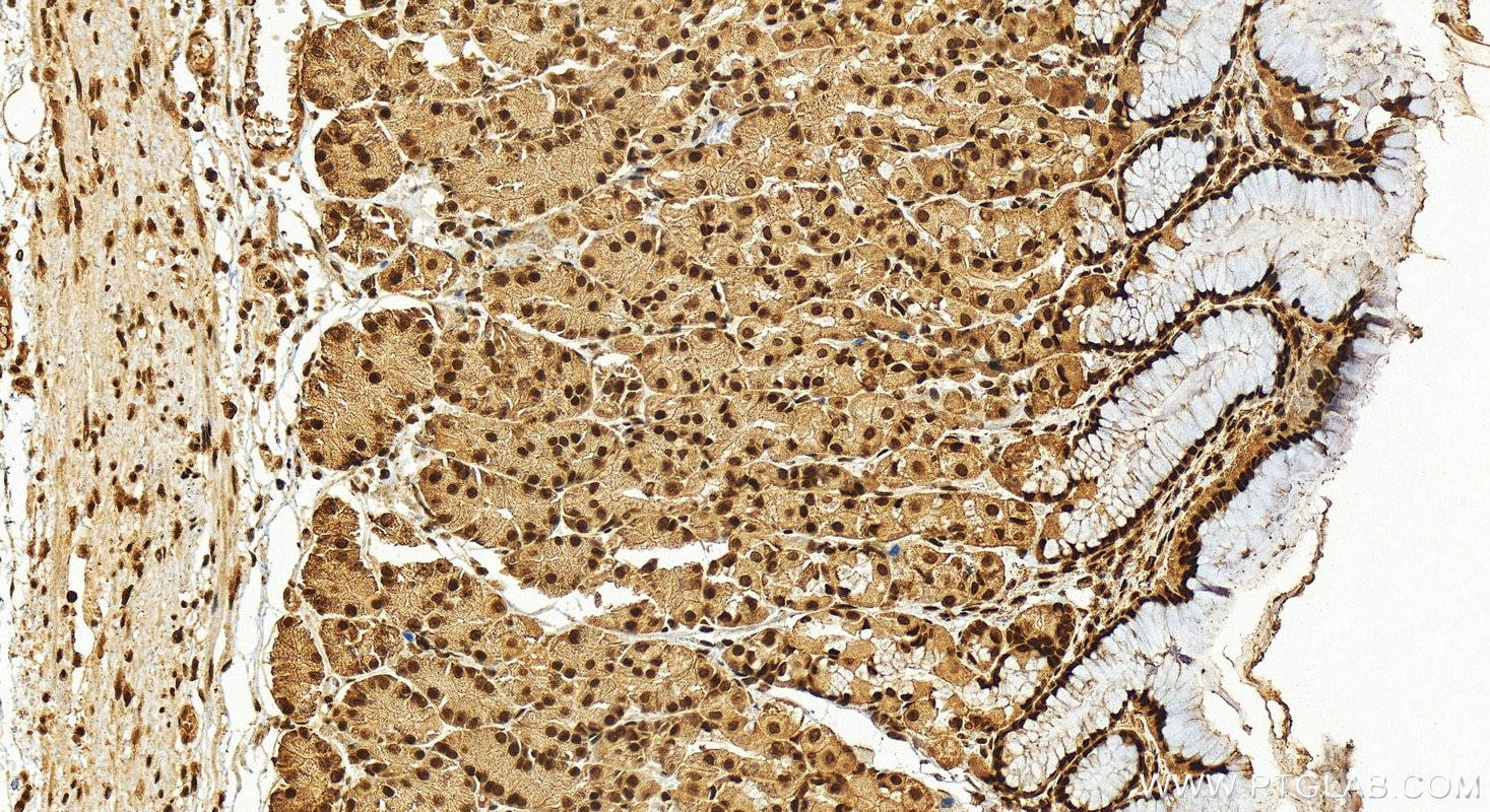 Immunohistochemistry (IHC) staining of human stomach tissue using STAG1 Polyclonal antibody (14015-1-AP)