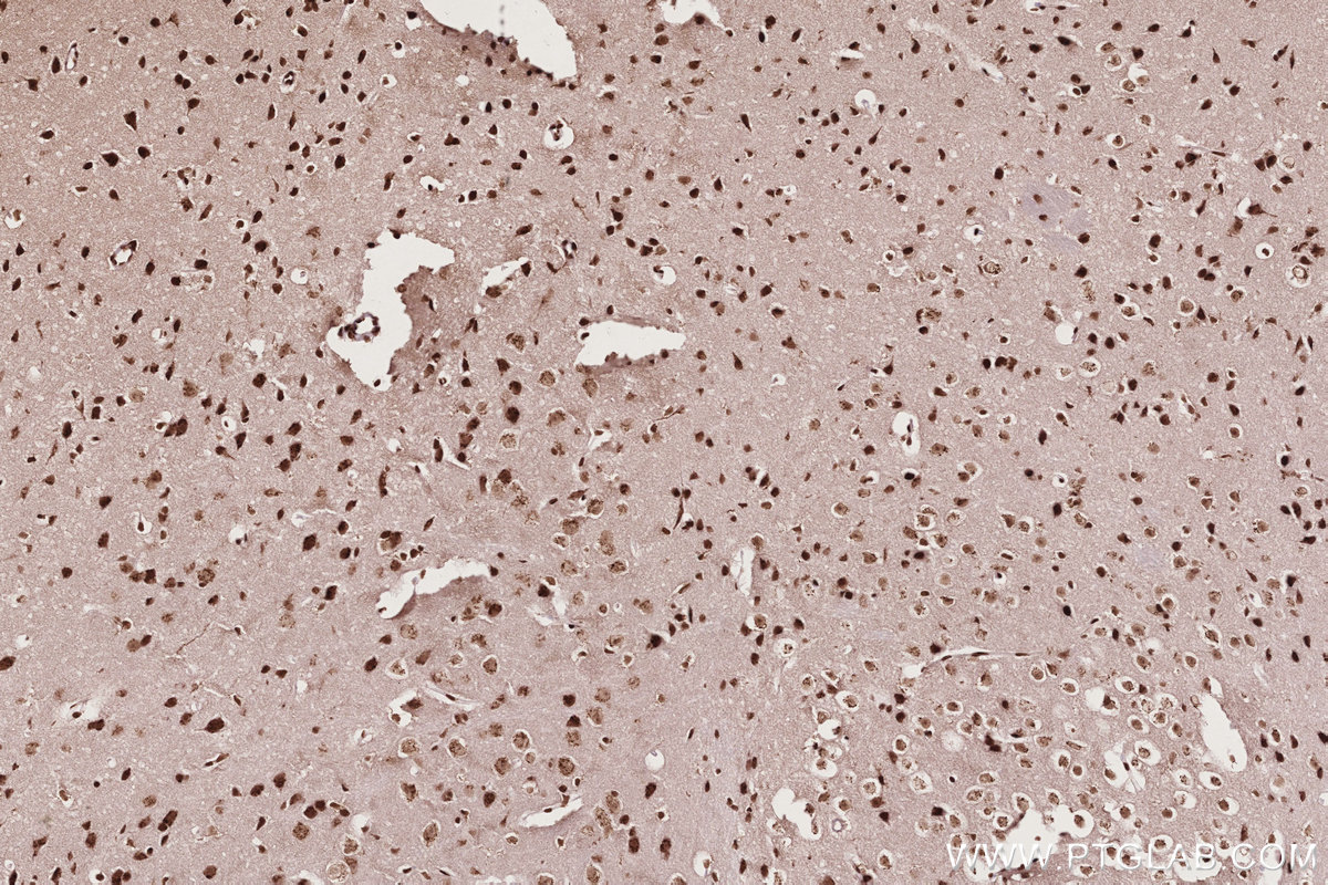 Immunohistochemistry (IHC) staining of mouse brain tissue using STAG1 Polyclonal antibody (14015-1-AP)