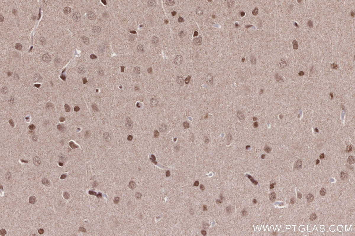 IHC staining of rat brain using 14015-1-AP Immunohistochemistry (IHC) staining of rat brain tissue using STAG1 Polyclonal antibody (14015-1-AP)
