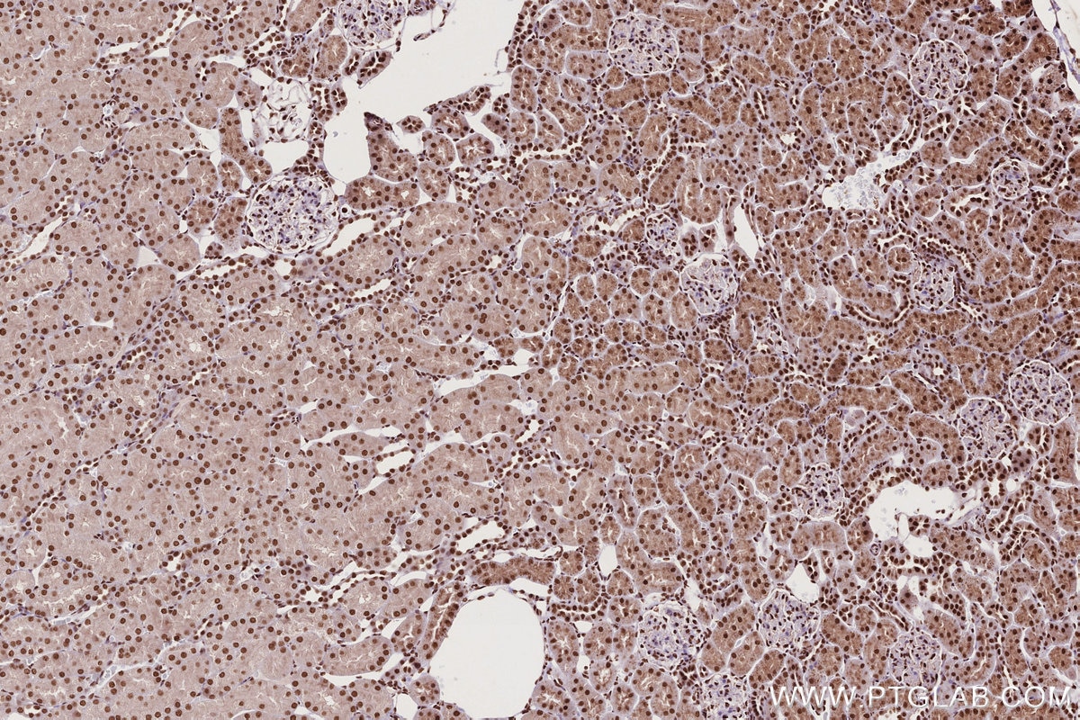 IHC staining of rat kidney using 14015-1-AP Immunohistochemistry (IHC) staining of rat kidney tissue using STAG1 Polyclonal antibody (14015-1-AP)