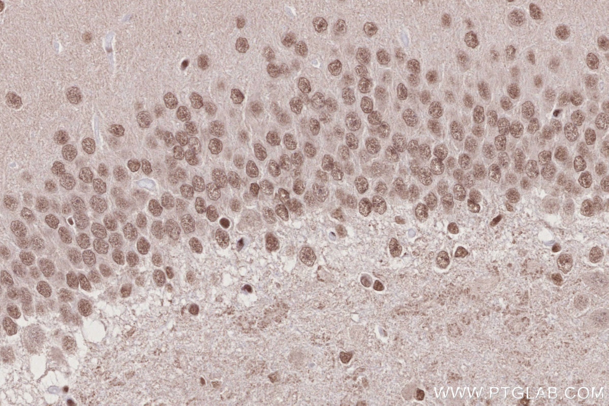 IHC staining of rat brain using 14015-1-AP Immunohistochemistry (IHC) staining of rat brain tissue using STAG1 Polyclonal antibody (14015-1-AP)