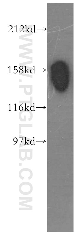 Western Blot (WB) analysis of HeLa cells using STAG1 Polyclonal antibody (14015-1-AP)