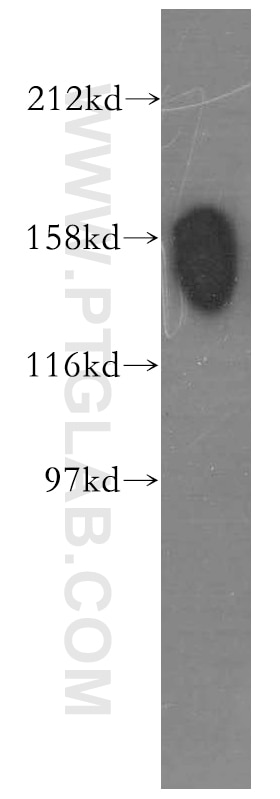 WB analysis of HeLa using 14015-1-AP