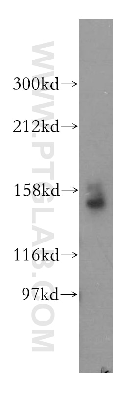Western Blot (WB) analysis of human heart tissue using STAG1 Polyclonal antibody (14015-1-AP)