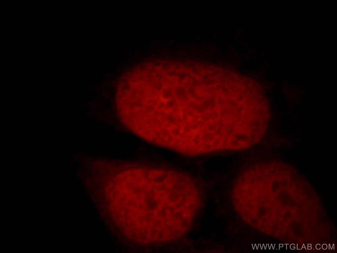 Immunofluorescence (IF) / fluorescent staining of HEK-293 cells using STAG2 Polyclonal antibody (19837-1-AP)