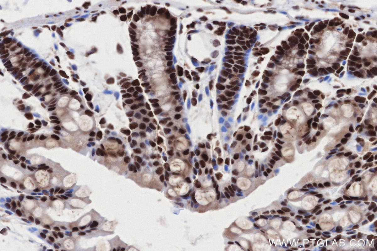 Immunohistochemistry (IHC) staining of mouse colon tissue using STAG2 Polyclonal antibody (19837-1-AP)