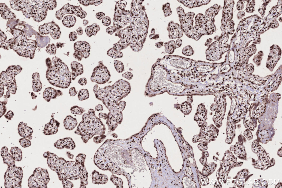 Immunohistochemistry (IHC) staining of human placenta tissue using STAG2 Polyclonal antibody (19837-1-AP)