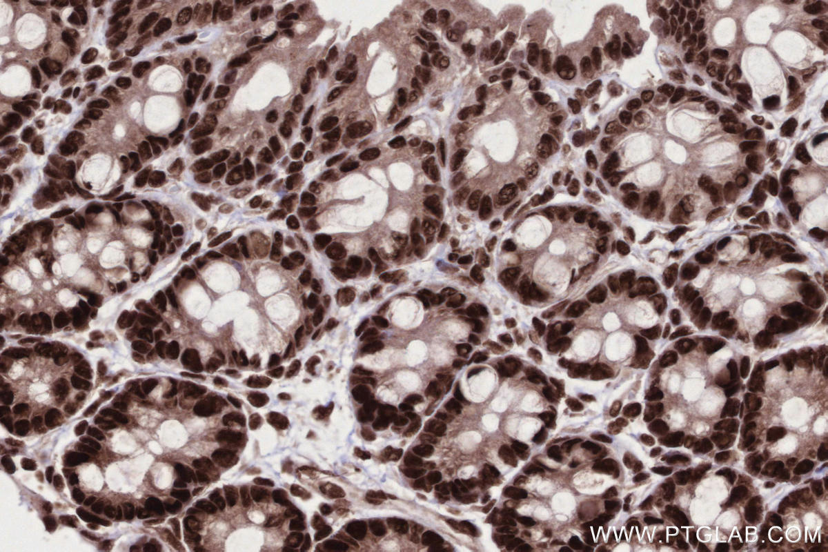 Immunohistochemistry (IHC) staining of rat colon tissue using STAG2 Polyclonal antibody (19837-1-AP)