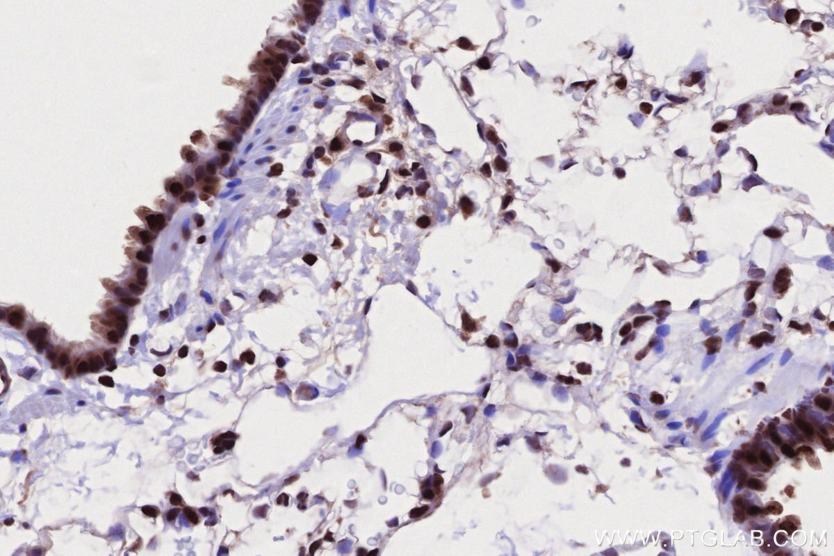 Immunohistochemistry (IHC) staining of rat lung tissue using STAG2 Polyclonal antibody (19837-1-AP)