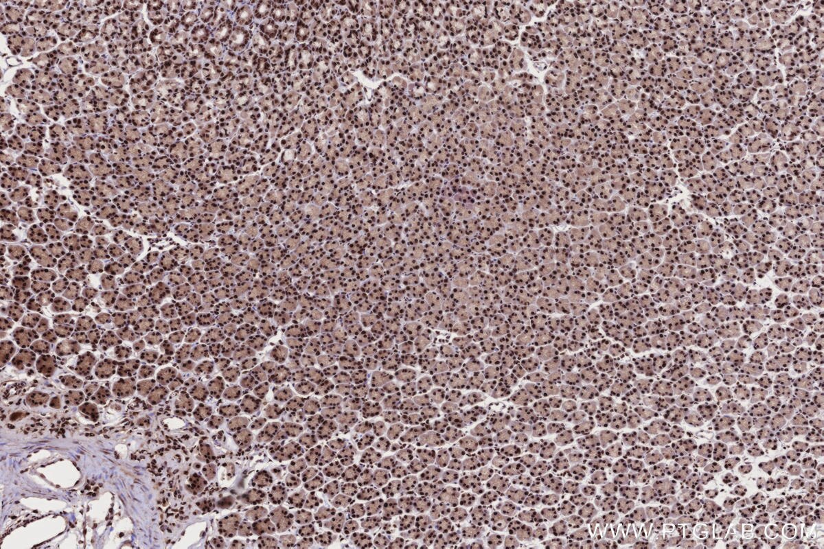 Immunohistochemistry (IHC) staining of rat stomach tissue using STAG2 Polyclonal antibody (19837-1-AP)
