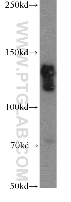 Western Blot (WB) analysis of HeLa cells using STAG2 Polyclonal antibody (19837-1-AP)