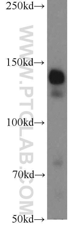 Western Blot (WB) analysis of K-562 cells using STAG2 Polyclonal antibody (19837-1-AP)