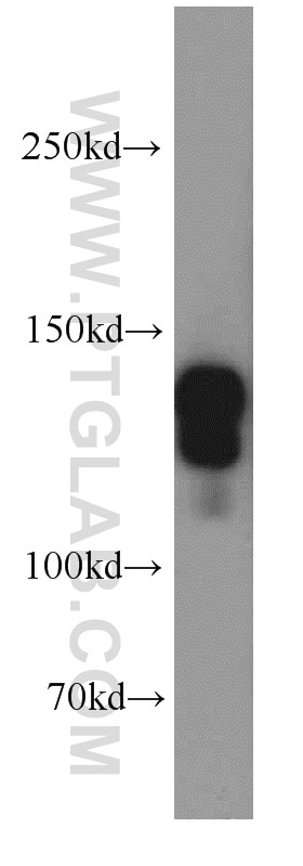 Western Blot (WB) analysis of Jurkat cells using STAG2 Polyclonal antibody (19837-1-AP)