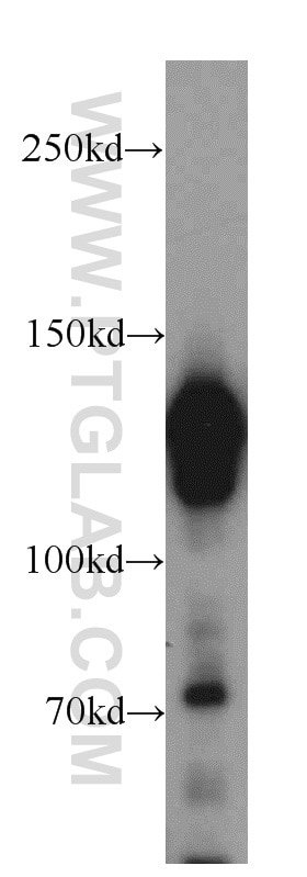 Western Blot (WB) analysis of MCF-7 cells using STAG2 Polyclonal antibody (19837-1-AP)