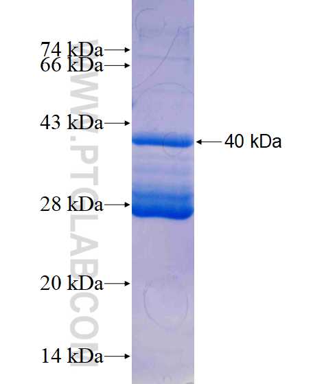 STAG2 fusion protein Ag13825 SDS-PAGE