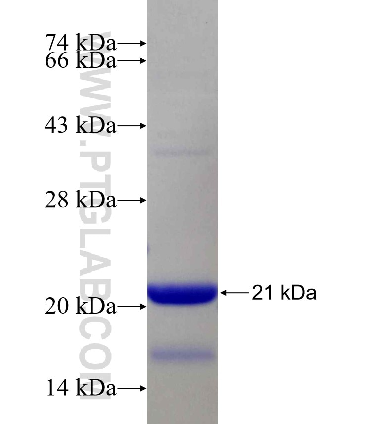 STAG2 fusion protein Ag14868 SDS-PAGE