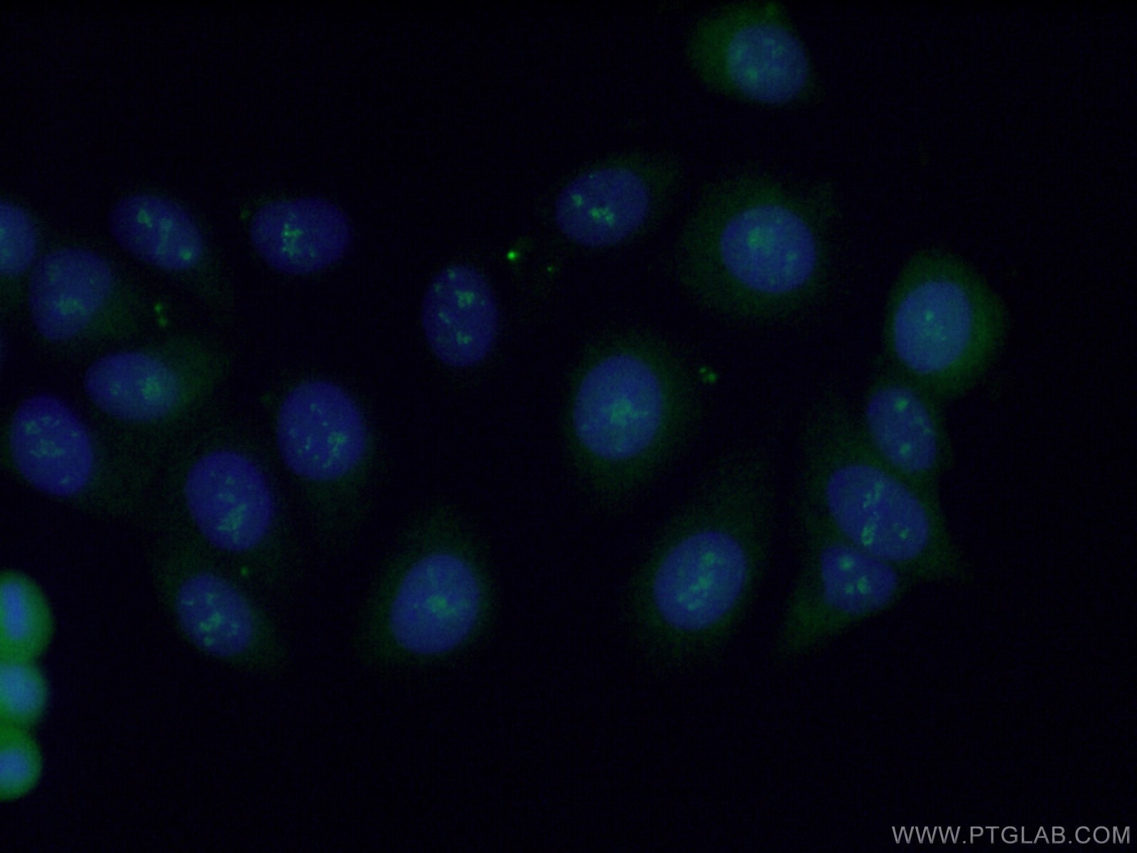 Immunofluorescence (IF) / fluorescent staining of MCF-7 cells using STAG3 Polyclonal antibody (23314-1-AP)
