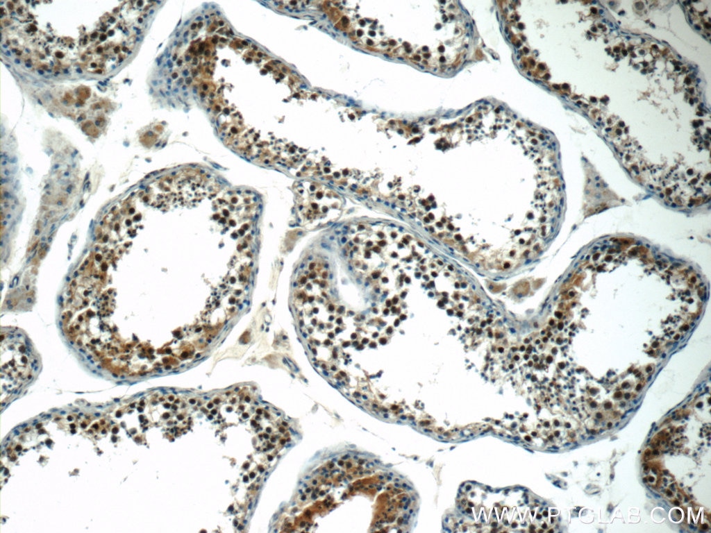 Immunohistochemistry (IHC) staining of human testis tissue using STAG3 Polyclonal antibody (23314-1-AP)