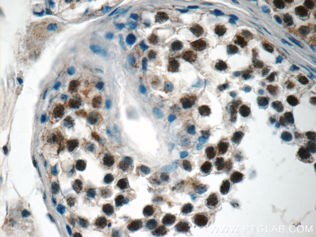 Immunohistochemistry (IHC) staining of human testis tissue using STAG3 Polyclonal antibody (23314-1-AP)