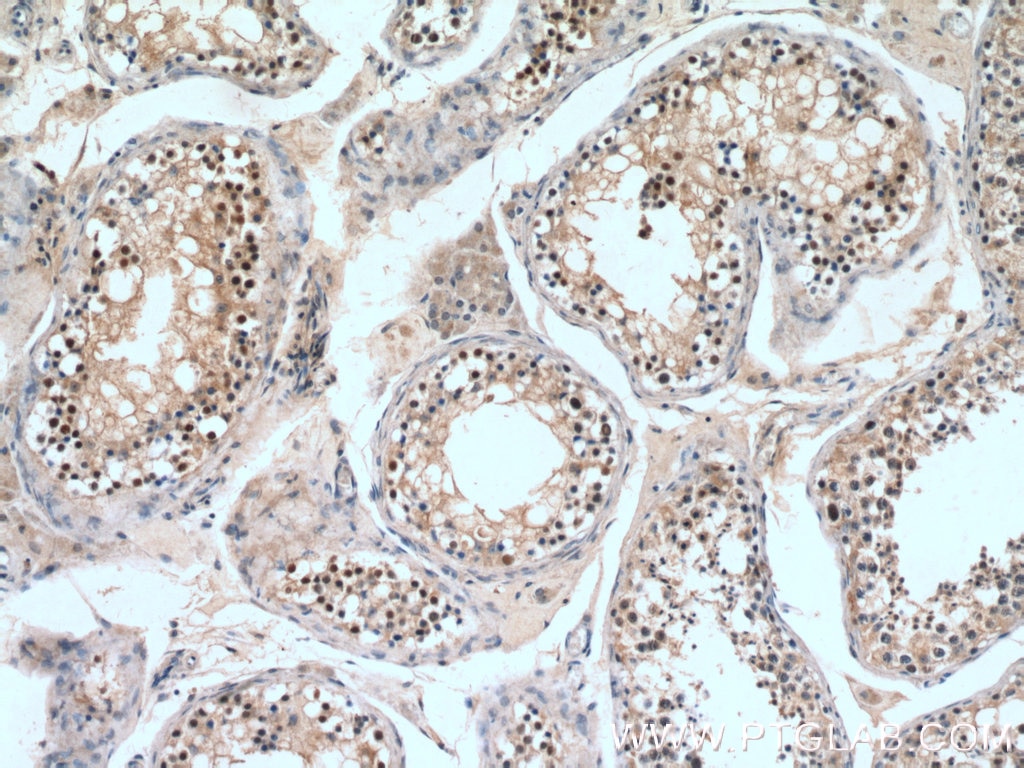Immunohistochemistry (IHC) staining of human testis tissue using STAG3 Polyclonal antibody (23314-1-AP)