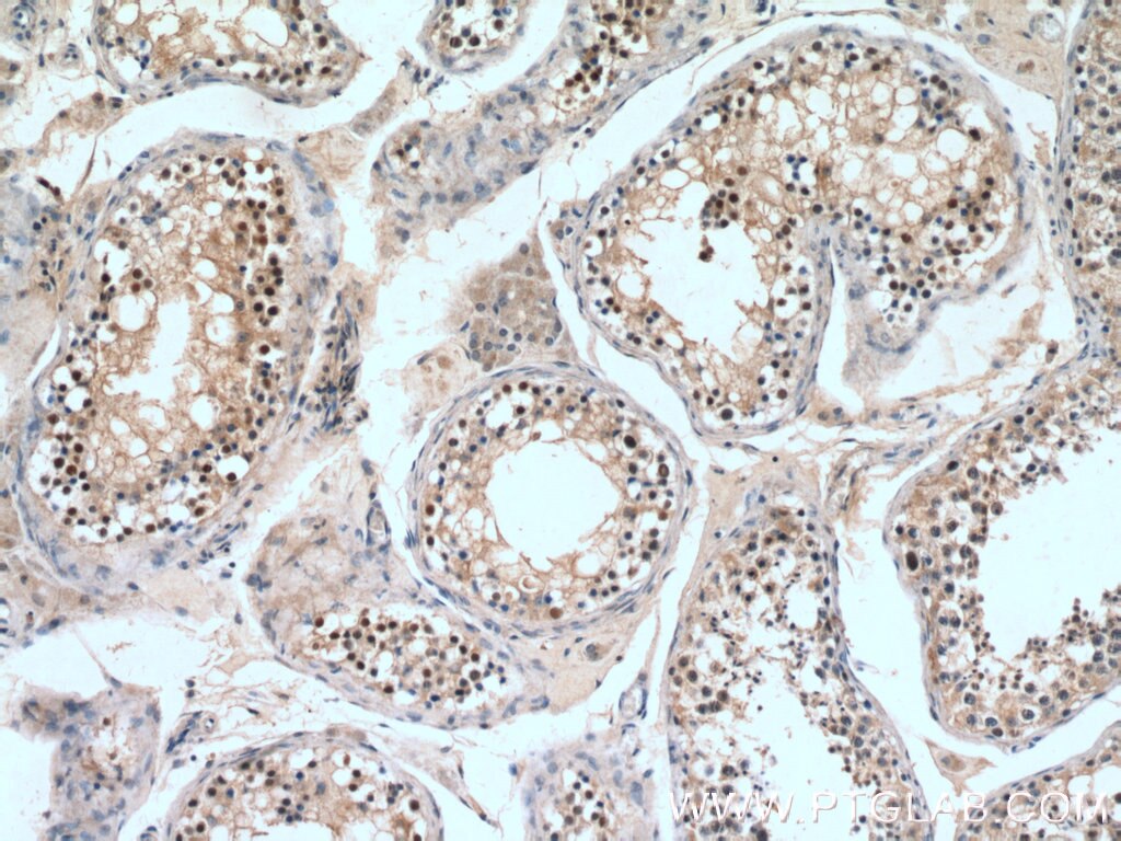 IHC staining of human testis using 23314-1-AP