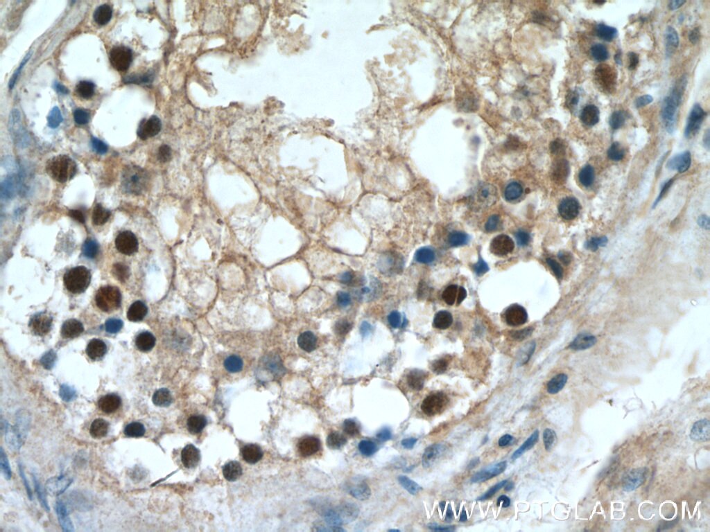 Immunohistochemistry (IHC) staining of human testis tissue using STAG3 Polyclonal antibody (23314-1-AP)