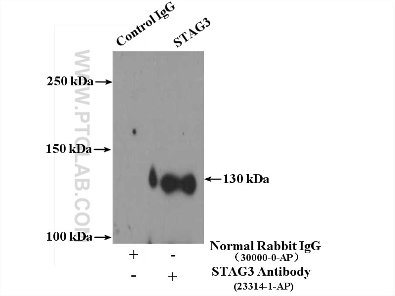 Immunoprecipitation (IP) experiment of human testis tissue using STAG3 Polyclonal antibody (23314-1-AP)