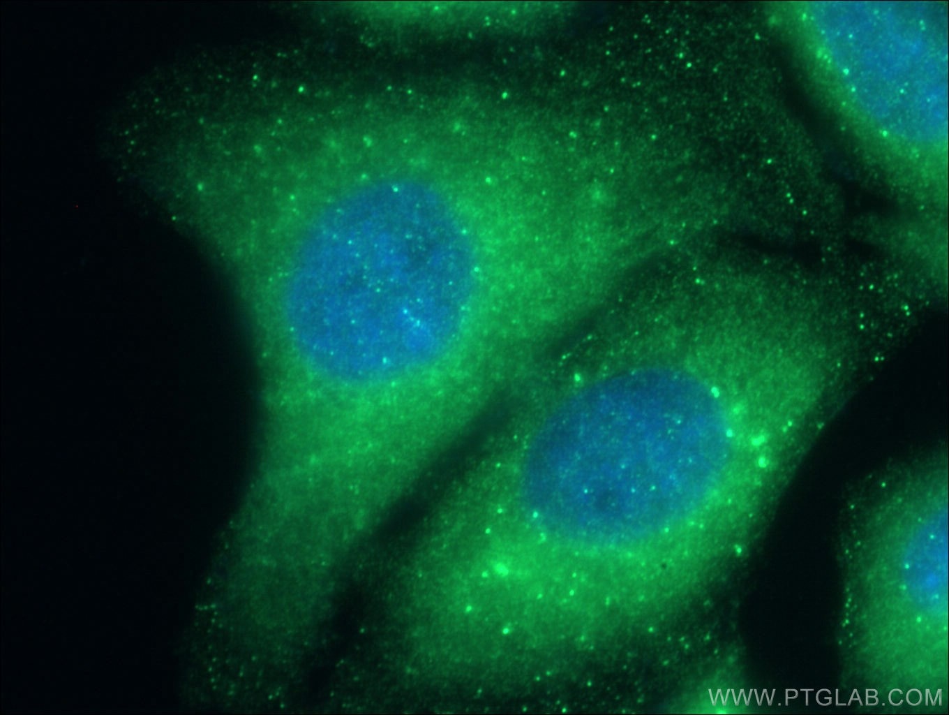 Immunofluorescence (IF) / fluorescent staining of HepG2 cells using STAM Polyclonal antibody (12434-1-AP)